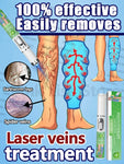 Vein problems Nanotherapy