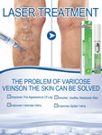 Hot sale Nano Laser Leg Vein